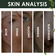 Acne Marks Blackhead Brightening Skin